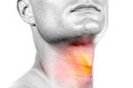Relazione tra cancro alla gola e virus HPV